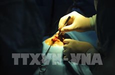 韩国外科专家为越南唇腭裂儿童进行免费手术治疗