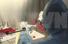 新冠肺炎疫情：集中资源研制新冠肺炎病毒检测试剂盒