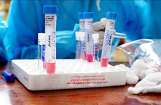 岘港市4家医疗机构具备开展新冠病毒检测的能力