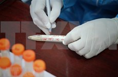 10月30日越南报告新增新冠肺炎确诊病例5227例