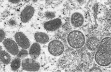 越南仍未发现猴痘病例  但将随时应对猴痘疫情爆发的风险