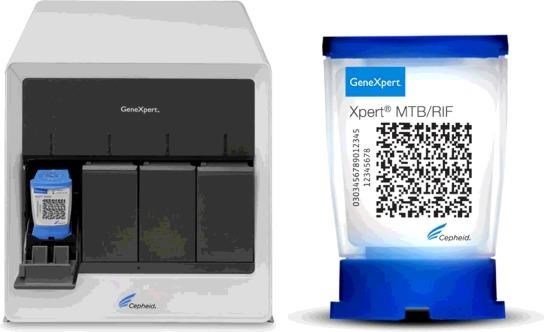 结核病防治计划Gene Xpert 检测系统可参与新冠肺炎病毒检测 hinh anh 1