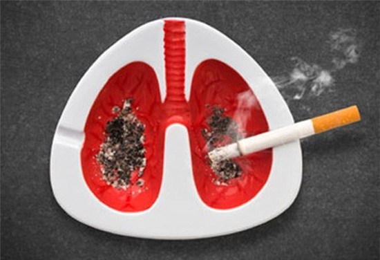 越南：吸烟导致约96.8%的肺癌患者死亡 hinh anh 1