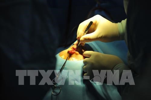 韩国外科专家为越南唇腭裂儿童进行免费手术治疗 hinh anh 1