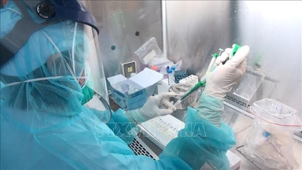 清化省新冠肺炎病毒分子生物学检测系统正式投入运行 hinh anh 1