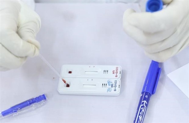 越南基本满足新冠病毒检测需要 hinh anh 2