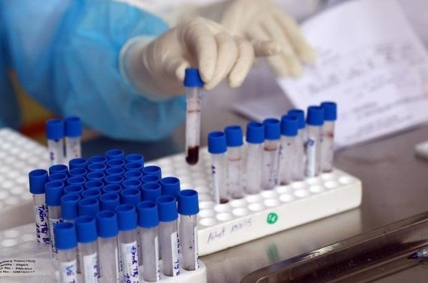 越南已掌握PCR和快速检测两种新冠肺炎病毒检测方法 hinh anh 2