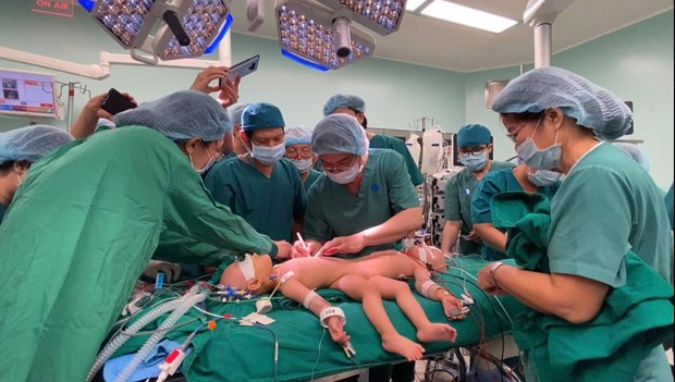 国际媒体纷纷报道越南下半身连体双胞胎女婴分离手术顺利成功 hinh anh 1
