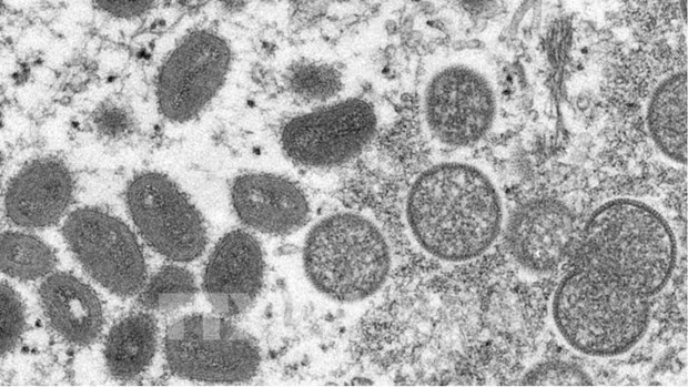 越南仍未发现猴痘病例 但将随时应对猴痘疫情爆发的风险 hinh anh 1