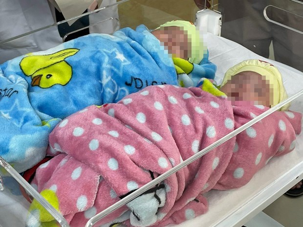 越南中央妇产医院首次成功保育胎龄25周出生体重仅500克的双胞胎 hinh anh 1